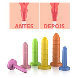 Kit de Dilatador Vaginal Graduados Anelado 6 Unidades Colorido
