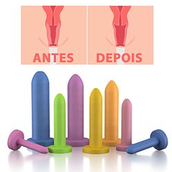 Kit de Dilatador Vaginal Graduados Liso 8 Unidades